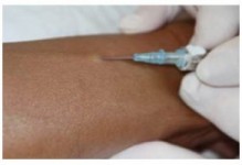 Peripheral IV Catheter Insertion: Overview & Demonstration